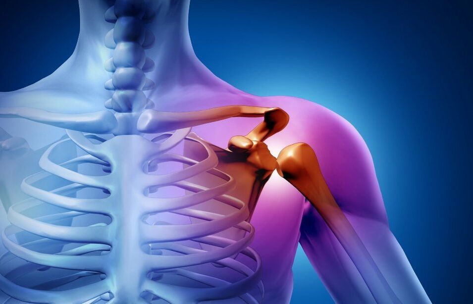 lesión en la articulación del hombro por artrosis