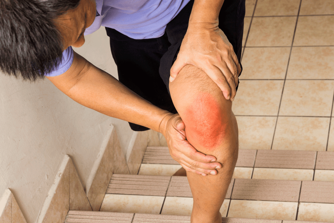 dolor en las articulaciones debido a la osteoartritis